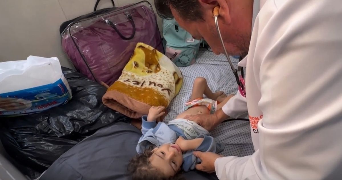 حالات تشوه الأجنة في قطاع غزة ترتفع بصورة غير مسبوقة