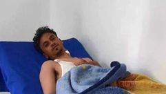 القيادي بجماعة الحوثي ابراهيم المحطوري بعد نجاته من الاغتيال - فيس بوك