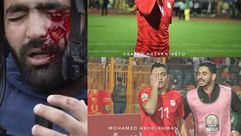 لاعبي المنتخب المصري يتضامنون مع الصحفي الفلسطيني معاذ الذي فقد عينه