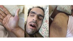 محمد سلطان إضراب عن الطعام مصر