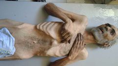 دياب عبد الرحمن - توفي في مضايا بسبب الحصار والجوع - سوريا