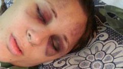امرأة مصرية تعرضت لمحاولة قتل ـ صحف مصرية