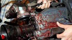 كاميرا صحفي مع دماء - سورية