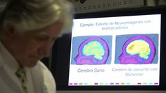طبيب يعاين صورة بالرنين المغناطيسي في كوبا