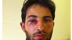 محمد الخطيب - صحفي ناشط إعلامي سوري - تعرض للضرب على يد حرس الحدود التركي خلال عبور الحدود 6-12-2015