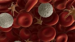 سرطان الدم ـ لوكيميا ـ تعبيرية