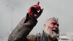 مسن مدني أصيب بشظايا قصف أمريكي على الموصل قبل أشهر- أرشيفية