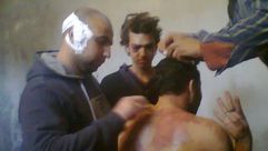 احد المعتقلين خلال تلقيه للعلاج بعد تعذيبه - فيس بوك