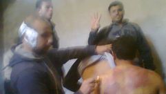صور مسربة من سجن مصري لاثار التعذيب على المعتقلين - صور مسربة من سجن مصري لاثار التعذيب على المعتقلي
