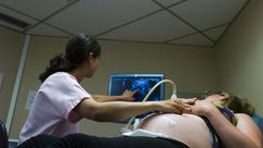 حامل تخضع للتصوير بالموجات فوق الصوتية في مستشفى في المنطقة الباريسية
