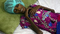 المجاعة في اليمن- جيتي