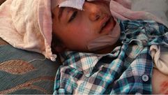طفل مصاب - قصف مدرسة جيل الحرية - بلدة قاح في ريف ادلب 27-4-2014