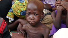 طفل يعاني من سوء التغذية في مخيم للاجئين في مدينة يولا شرق نيجيريا، في 5 ايار/مايو 2015
