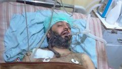 الطبيب نبيل الدعاس - قتل بنيران النصرة وفيلق الشام خلال القتال مع جيش الإسلام في دوما الغوطة سوريا