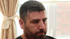 مواطن تركي أصيب لإي أحداث واشنطن أمام سفارة تركيا- الأناضول
