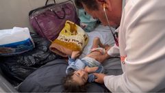 طفلة تعاني من سوء التغذية في قطاع غزة- وفا