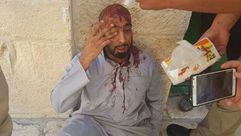 أحد المعتكفين ينزف بعد اعتداء قوات الاحتلال عليه- فيسبوك