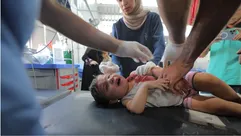 طفل مصاب نتيجة قصف الاحتلال على قطاع غزة- الأناضول