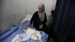 الطفل الفلسطيني الرضيع هاني الذي بترت ساقه نتيجة القصف الإسرائيلي على غزة - الأناضول