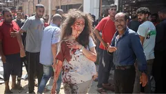 إصابة الصحفية بيان أبو سلطان في مجزرة استراحة الباقة على شاطئ مدينة غزة- جيتي