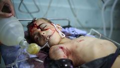 أعداد الشهداء بغزة في ارتفاع جراء استمرار العدوان الإسرائيلي - aa_picture_20140724_2879553_web