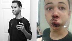 الفتى طارق ابو خضير ويظهر عليه اثار تعذيب الشرطة الاسرائيلية - فيس بوك