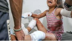 سوريا ادلب قصف لقوات النظام طفلة مصابة الاناضول