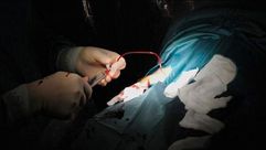 أطباء يجرون عملية جراحية على ضوء الهواتف المحمولة جراء أزمة الكهرباء بمصر - أرشيفية