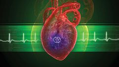 القلب جهاز نوبات  قلب