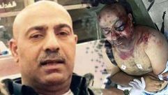 أحمد عز حلاوة - قتل بعد اعتقاله من السلطة الفلسطينية بتهمة قتل شرطيين - نابلس