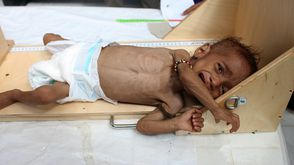 اليمن مجاعة معاناة حرب - جيتي