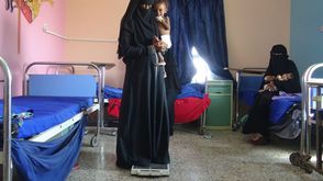 اليمن سوء تغذية حرب معاناة - جيتي