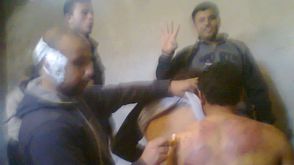 صور مسربة من سجن مصري لاثار التعذيب على المعتقلين - صور مسربة من سجن مصري لاثار التعذيب على المعتقلي