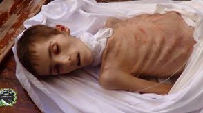 طفل توفي بسبب الجوع والحصار - المعضمية - الغوطة - ريف دمشق - سوريا