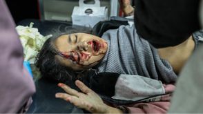 غزة جرحى اطفال- جيتي