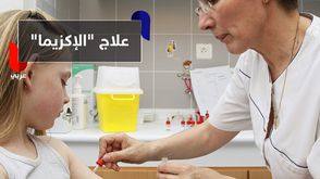 علاج "الإكزيما"