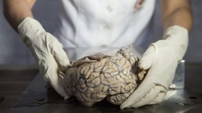 يتعارض تقرير حديث مفاده أن الدماغ يستمرّ في إنتاج الخلايا العصبية مع القدّم في السنّ مع دراسة نشرت ا