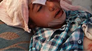 طفل مصاب - قصف مدرسة جيل الحرية - بلدة قاح في ريف ادلب 27-4-2014