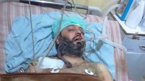 الطبيب نبيل الدعاس - قتل بنيران النصرة وفيلق الشام خلال القتال مع جيش الإسلام في دوما الغوطة سوريا