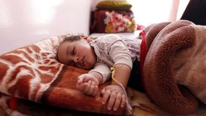 طفل يمني مصاب بالكوليرا يتلقى العلاج في صنعاء - أ ف ب