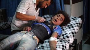 طفل مصاب - قصل بلدة أوتايا الغوطة الشرقية - سوريا عربي21.