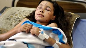 "دينا" أغمضت عينيها خوفا من الصواريخ الإسرائيلية..وتعجز عن فتحها مجددا  - الأناضول غزة