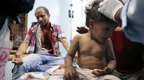 طفل يمني يتلقى العلاج إثر إصابته ـ أ ف ب