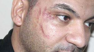 العامل المصري وآثار الضرب بادية على وجهه - أرشيفية