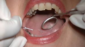 اتحاد أطباء الأسنان البريطانيين يقول إن فحص أسنان اللاجئين "غير مناسب وغير أخلاقي"- أرشيفية