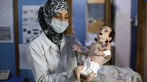 منظمات دولية حذرت من كارثة تهدد حياة آلاف الأطفال في الغوطة المحاصرة من قوات النظام السوري- جيتي 