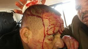 صورة لمصاب في التفجير الذي استهدف متضامنين مع نظام الأسد تداولها نشطاء على فيسبوك