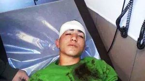 الفتى المقدسي مالك حمودة وقد أصيب بطلق مطاطي في رأسه - عربي21