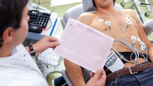 رسم القلب (ECG) يسجل النشاط الكهربائي للقلب ويتغير نمطه في الحالات القلبية المرضية