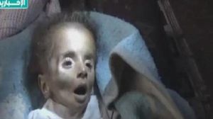 طفل فلسطيني بمخيم اليرموك يموت جوعا - ا ف ب